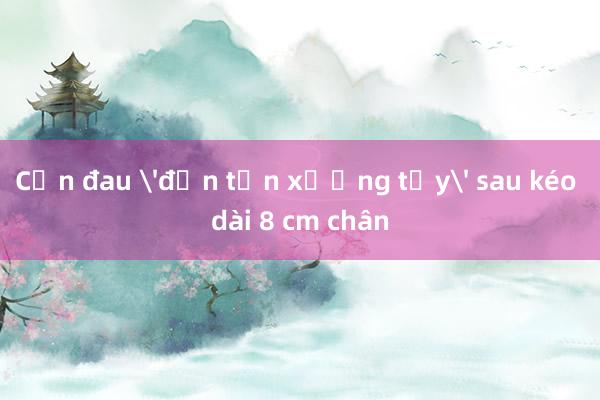 Cơn đau 'đến tận xương tủy' sau kéo dài 8 cm chân